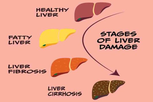 Liver Disease: Top Warning Signs And Symptoms, Causes, Diagnosis 